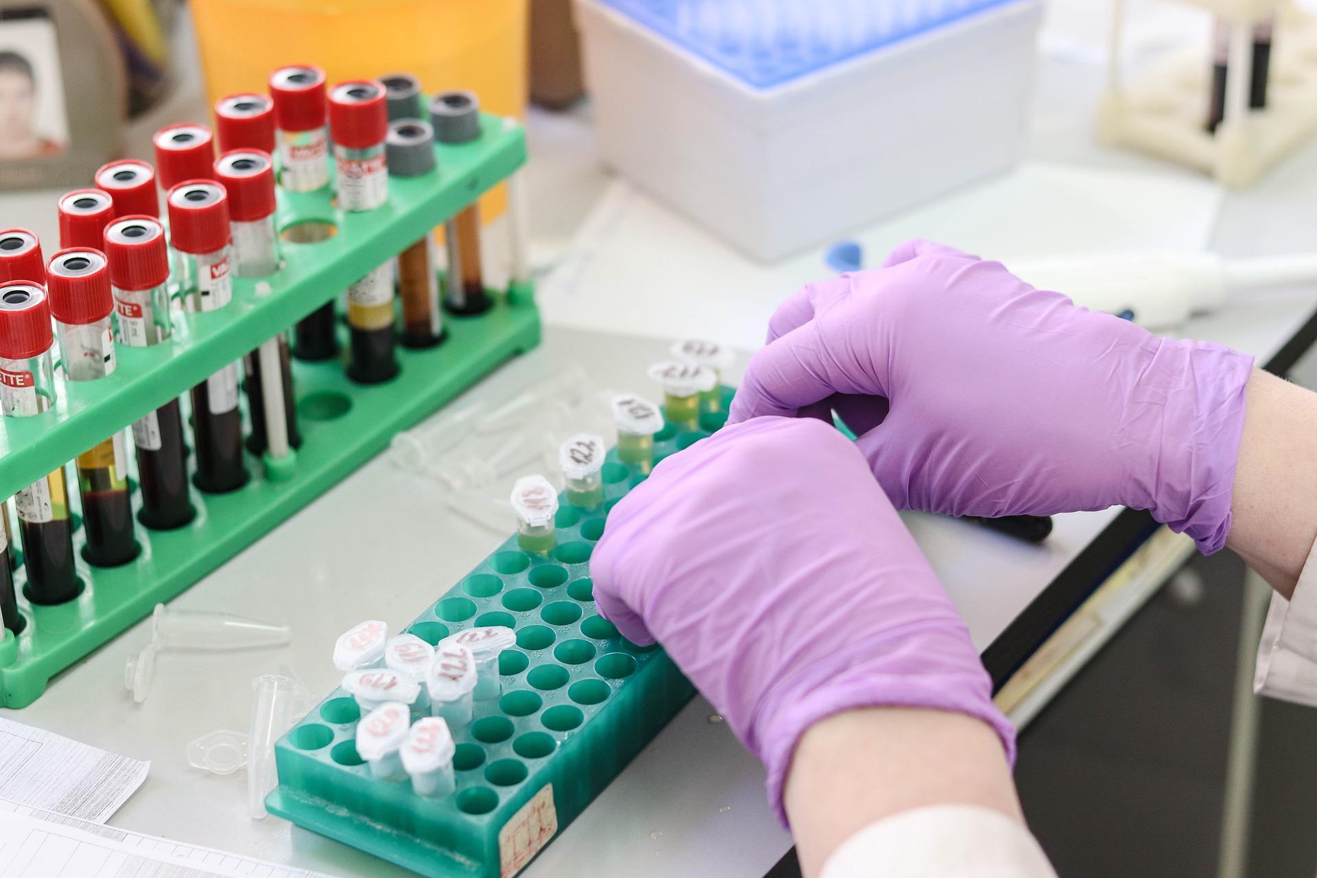 blood-test
