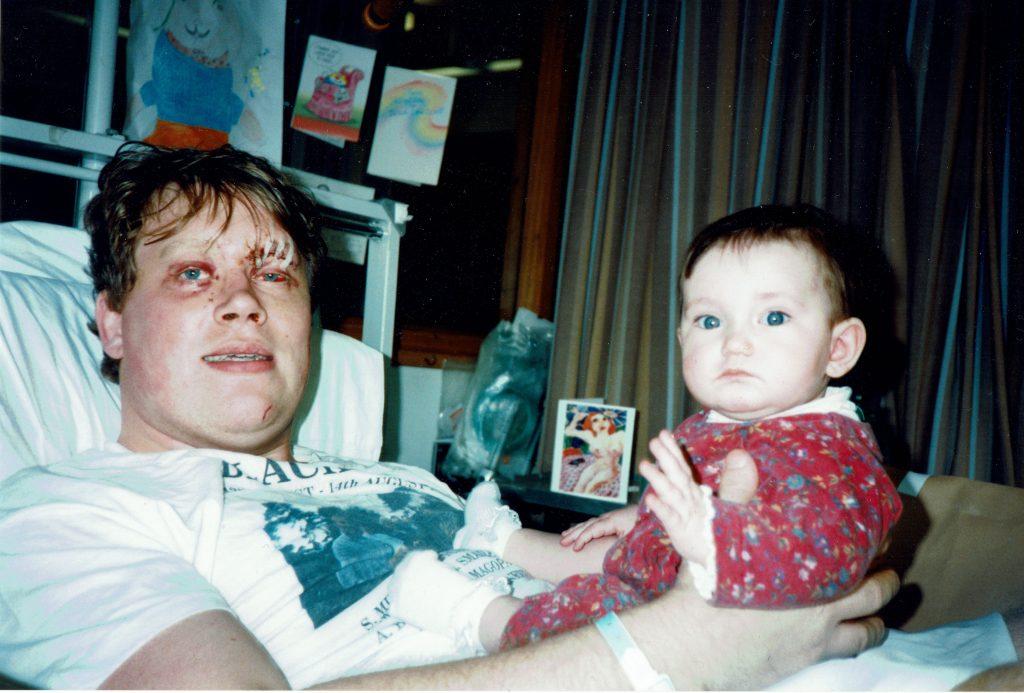 Jonty in hospital after the car crash