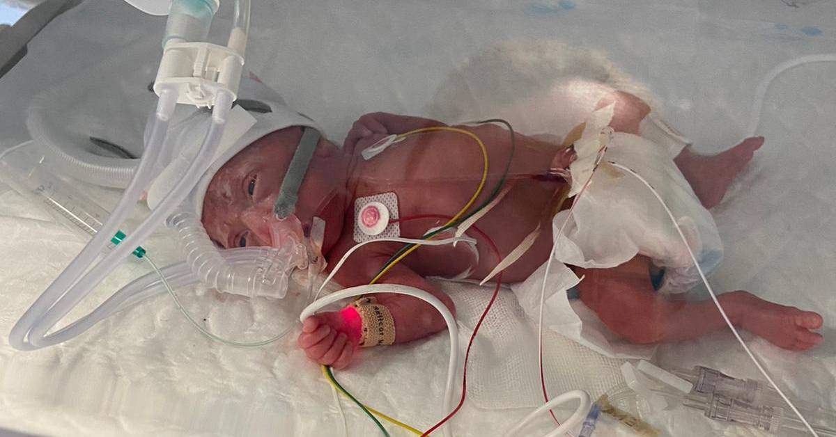 Harrogate mum’s ‘miracle baby’ born on holiday three months early